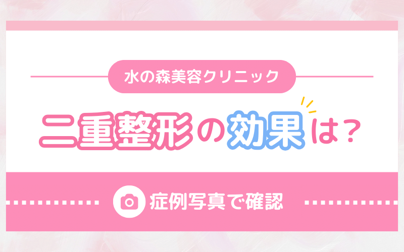 水の森美容クリニック 二重整形の効果は？埋没は上手い？症例写真で確認！