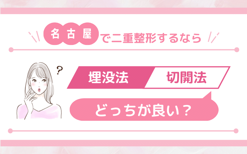 名古屋で二重整形するなら埋没切開どっちがいい？デザインは？基礎知識を解説