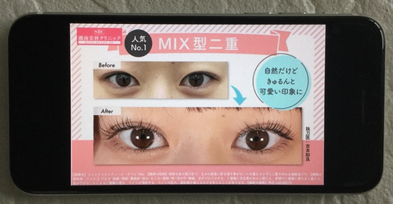 Mix型