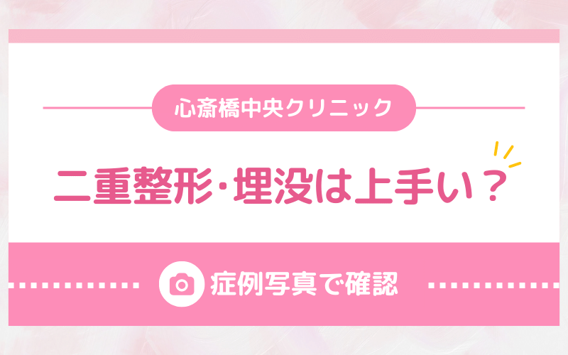 心斎橋中央クリニックの二重整形・埋没は上手い？症例写真で確認！