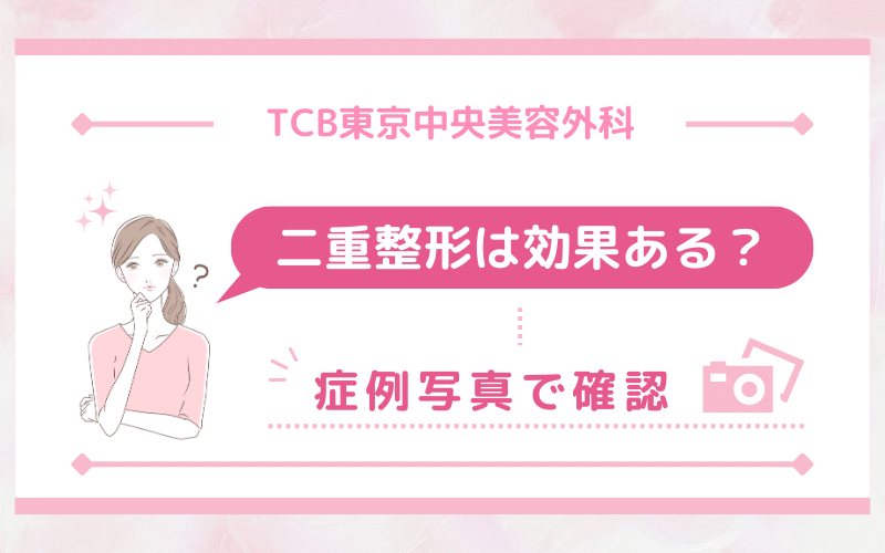 TCB東京中央美容外科の二重整形は効果ある？症例写真で確認！