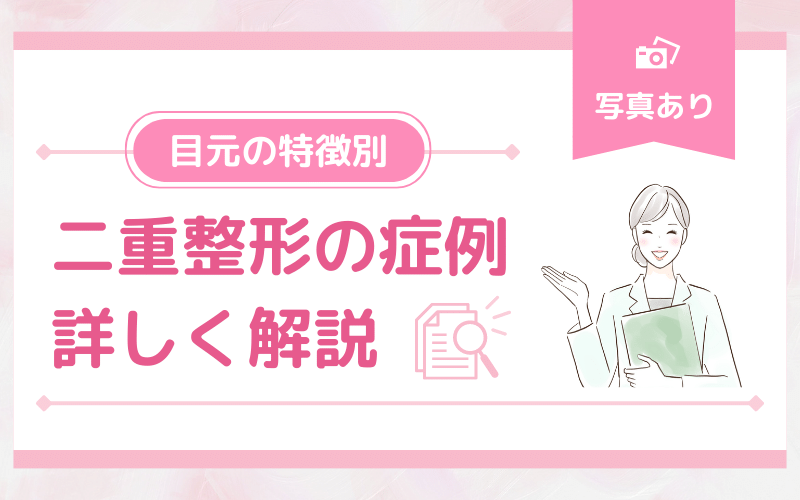 成功しやすい人でなくても大丈夫！目元の特徴別・二重整形の症例を解説！