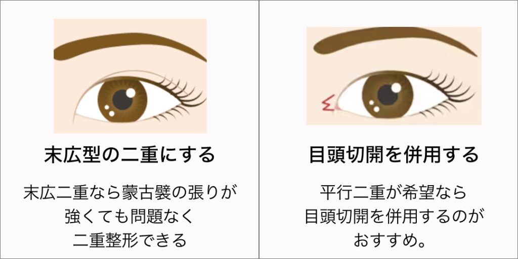 蒙古襞の張りが強い人の対策